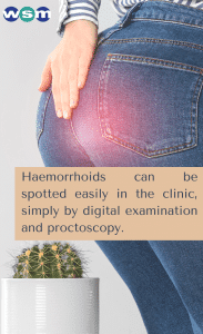 Hemorrhoids Can Be Spotted