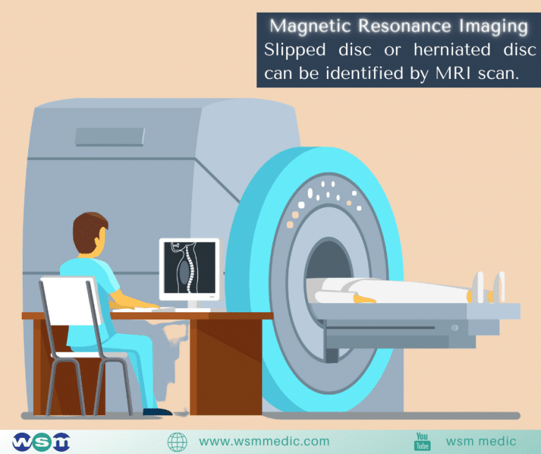 MRI Scan for slipped disc, herniated disc