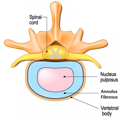 Healthy disc